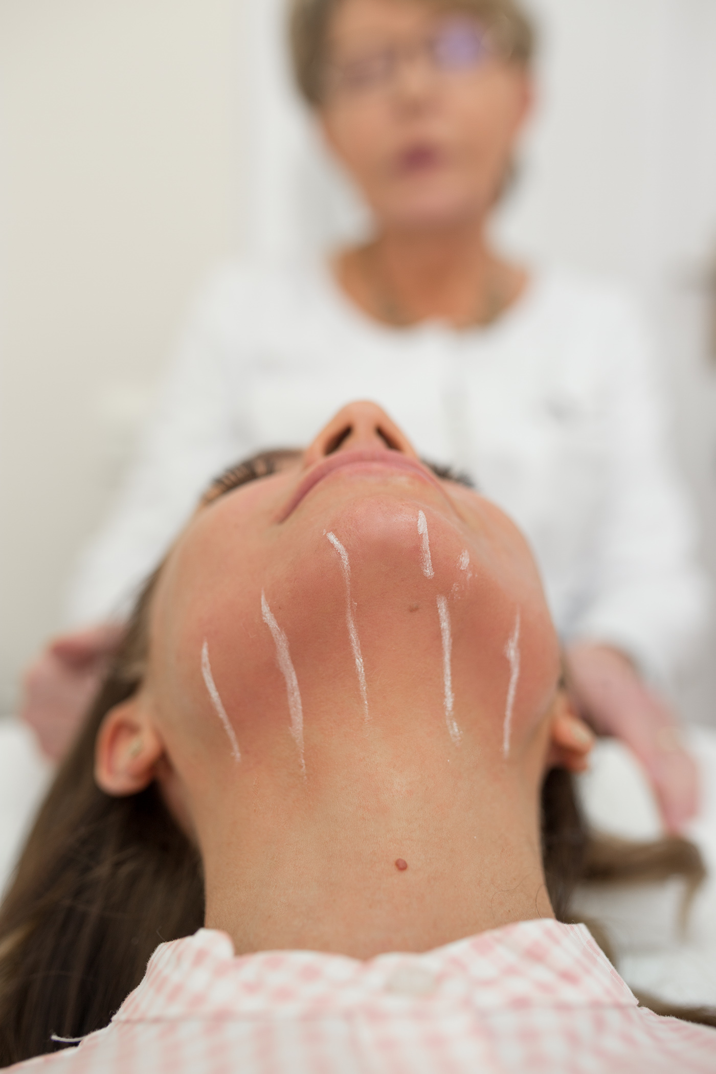 Zabieg Ulthera, nieinwazyjny lifting twarzy, Skin Laser Lubelscy