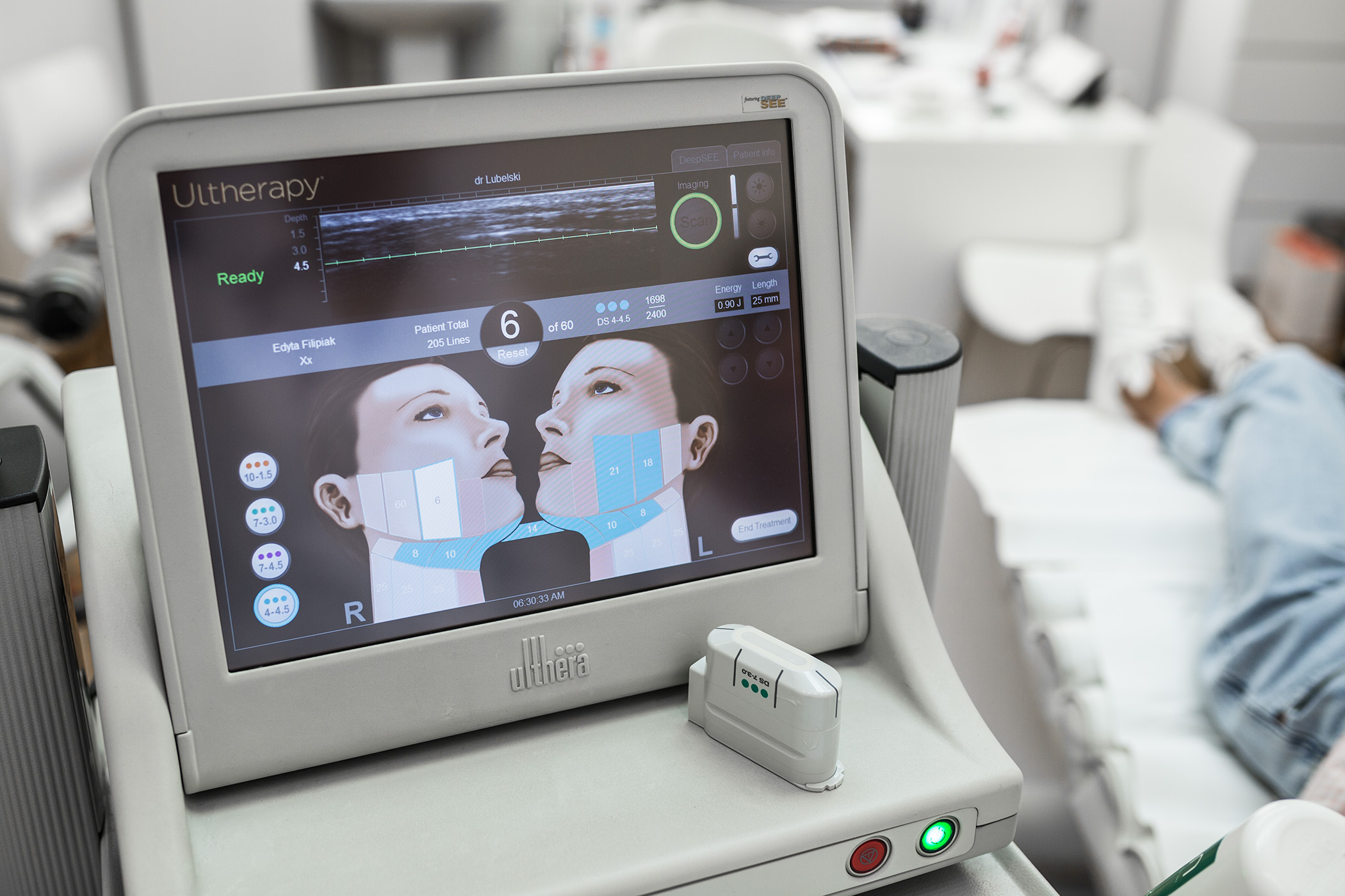 Zabieg Ulthera, nieinwazyjny lifting twarzy, Skin Laser Lubelscy